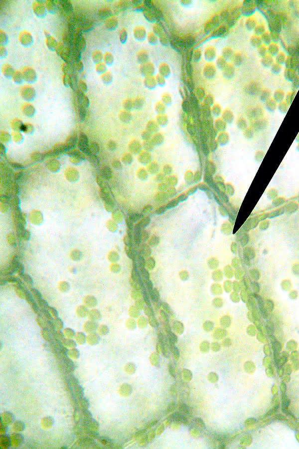 Chloroplasten im Lichtmikroskop (Wasserpest)